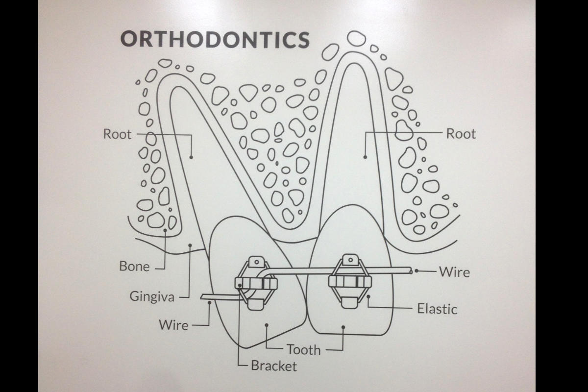 Teeth mural at Dentist